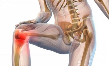 Kniegelenks -Osteoarthritis