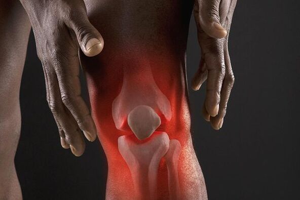 Symptome einer Arthrose