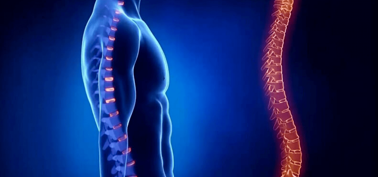 Wirbelsäulenverletzungen aufgrund von Osteochondrose.